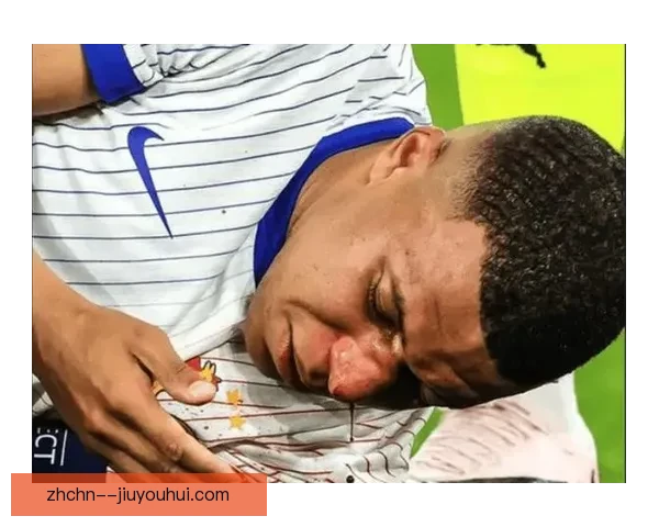 姆巴佩欧洲杯首秀受伤引法国球迷心疼关注